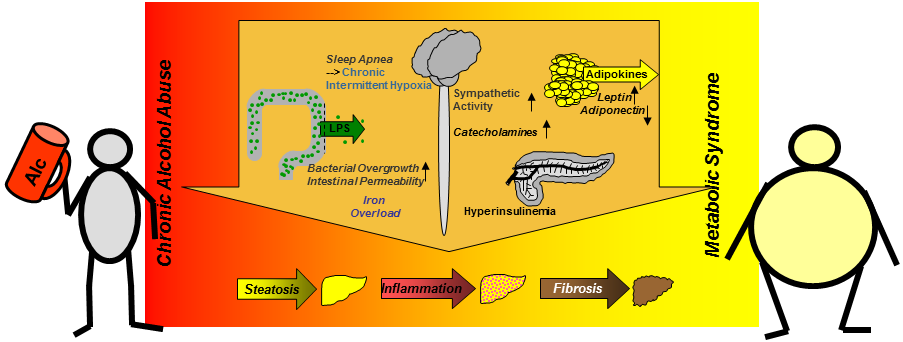 Combined effects of alcohol and metabolic syndrome