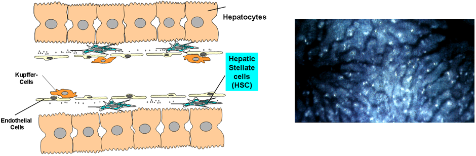 Hepatic stellate cells