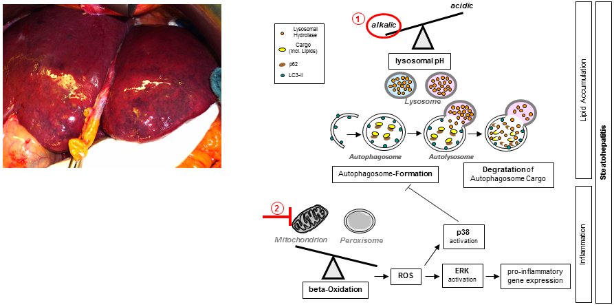 Chemotherapy-induced liver injury